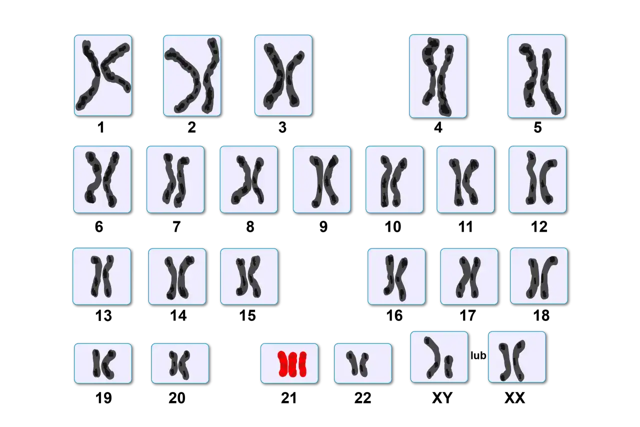 Rodzaje mutacji chromosomowych zespół Downa